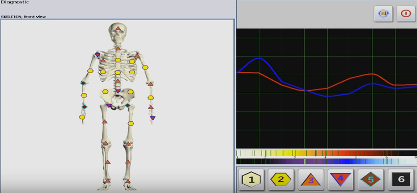 NLS Matrix Decoder Online Session